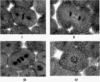 <strong> Examine the micrographs above and answer the following question(s). The cell in micrograph IV is at which stage of the cell cycle?</strong> A) prophase B) telophase C) interphase D) anaphase E) metaphase