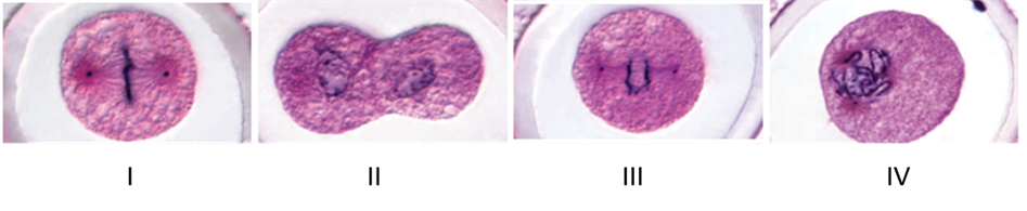 <strong>Examine the micrographs below to answer the following question. The cell in micrograph IV is at which stage of the cell cycle?</strong> A) prophase B) telophase C) interphase D) anaphase E) metaphase