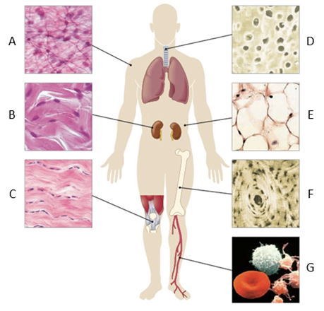 In the given figure, ____ is responsible for soft tissue support.