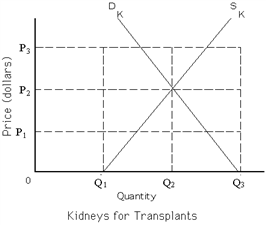 <strong>Exhibit 4-5 Refer to Exhibit 4-5. Suppose the government imposes a price ceiling at P = $0 for transplanted kidneys. The result will be a</strong> A)shortage of kidneys equal to (Q<sub>3</sub> - Q<sub>1</sub>). B)surplus of kidneys equal to (Q<sub>3</sub> - Q<sub>1</sub>). C)shortage of kidneys equal to (Q<sub>2</sub> - Q<sub>1</sub>). D)surplus of kidneys equal to (Q<sub>2</sub> - Q<sub>1</sub>).